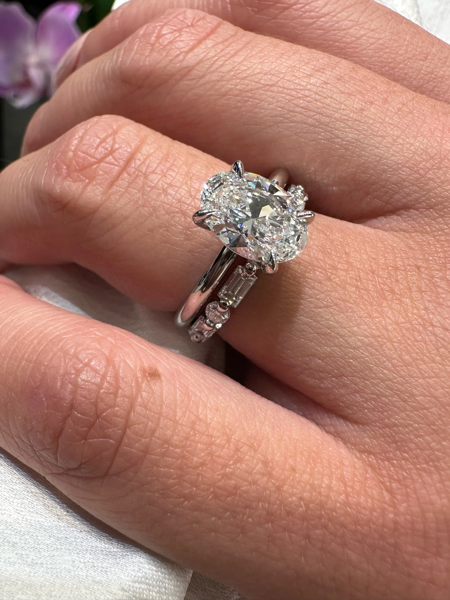 The Vida Diamond Band - Image 3